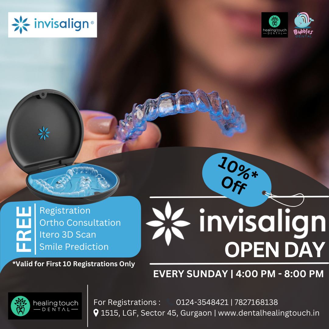 Invisalign Open Day in Gurgaon