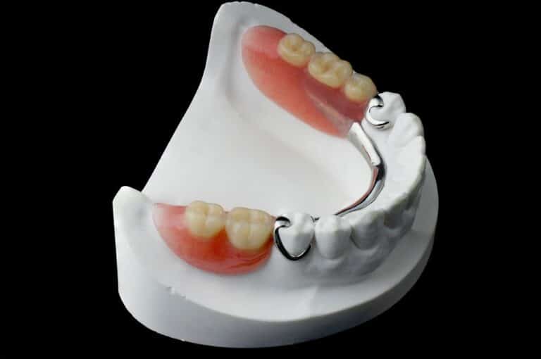 Partial-Dentures