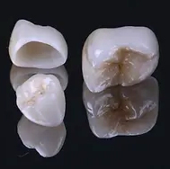 ZIRCONIA