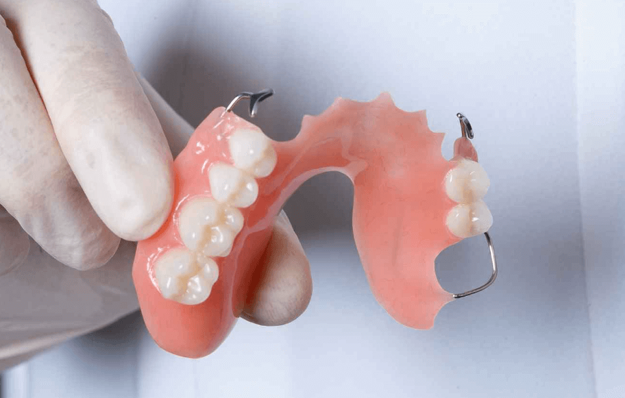 acrylic-partial-denture